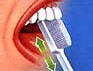 Zahnputztechnik - Zahnflächen innen